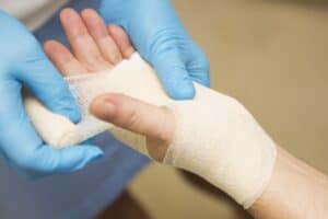 Nurse is treating patient after carpal tunnel syndrome operation at plastic surgery