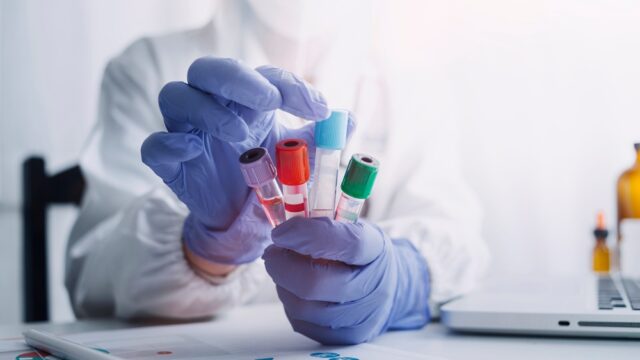 Doctor hand taking a sample tube from a rack with machines.