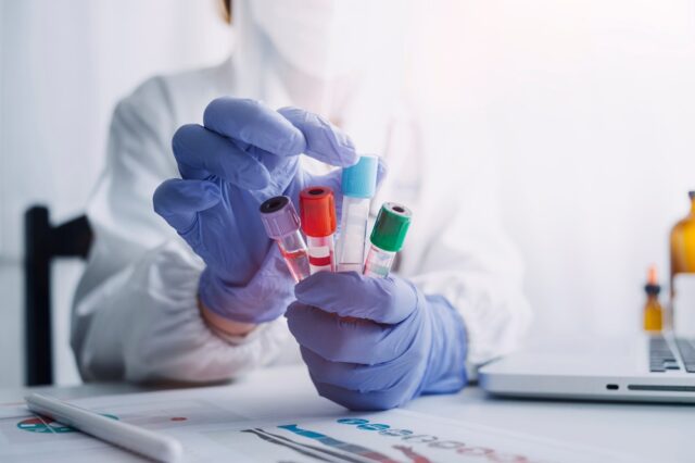 Doctor hand taking a sample tube from a rack with machines.